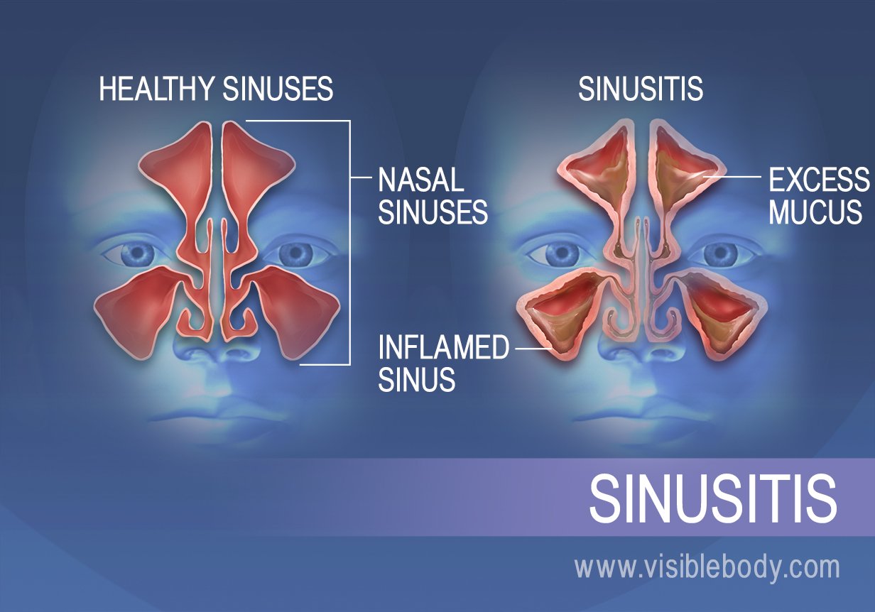 respiratory-diseases-and-disorders