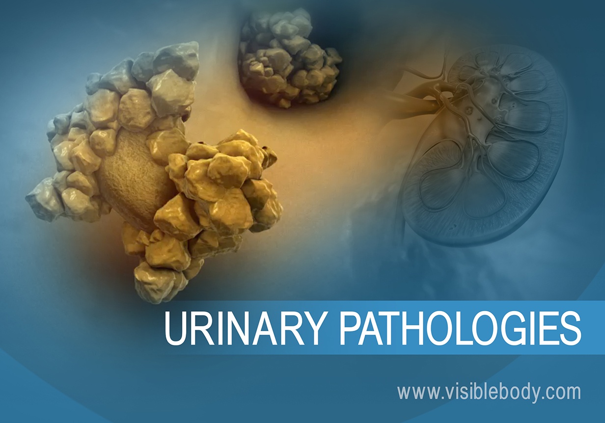 Urine System Pathologies