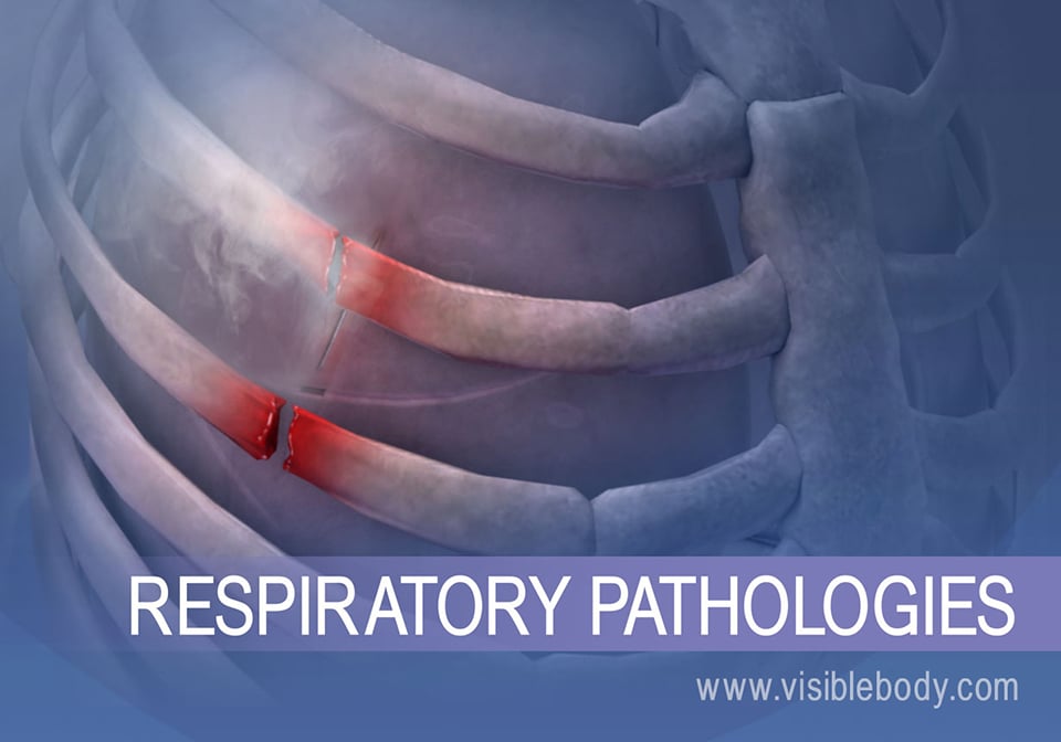 Respiratory Diseases And Disorders